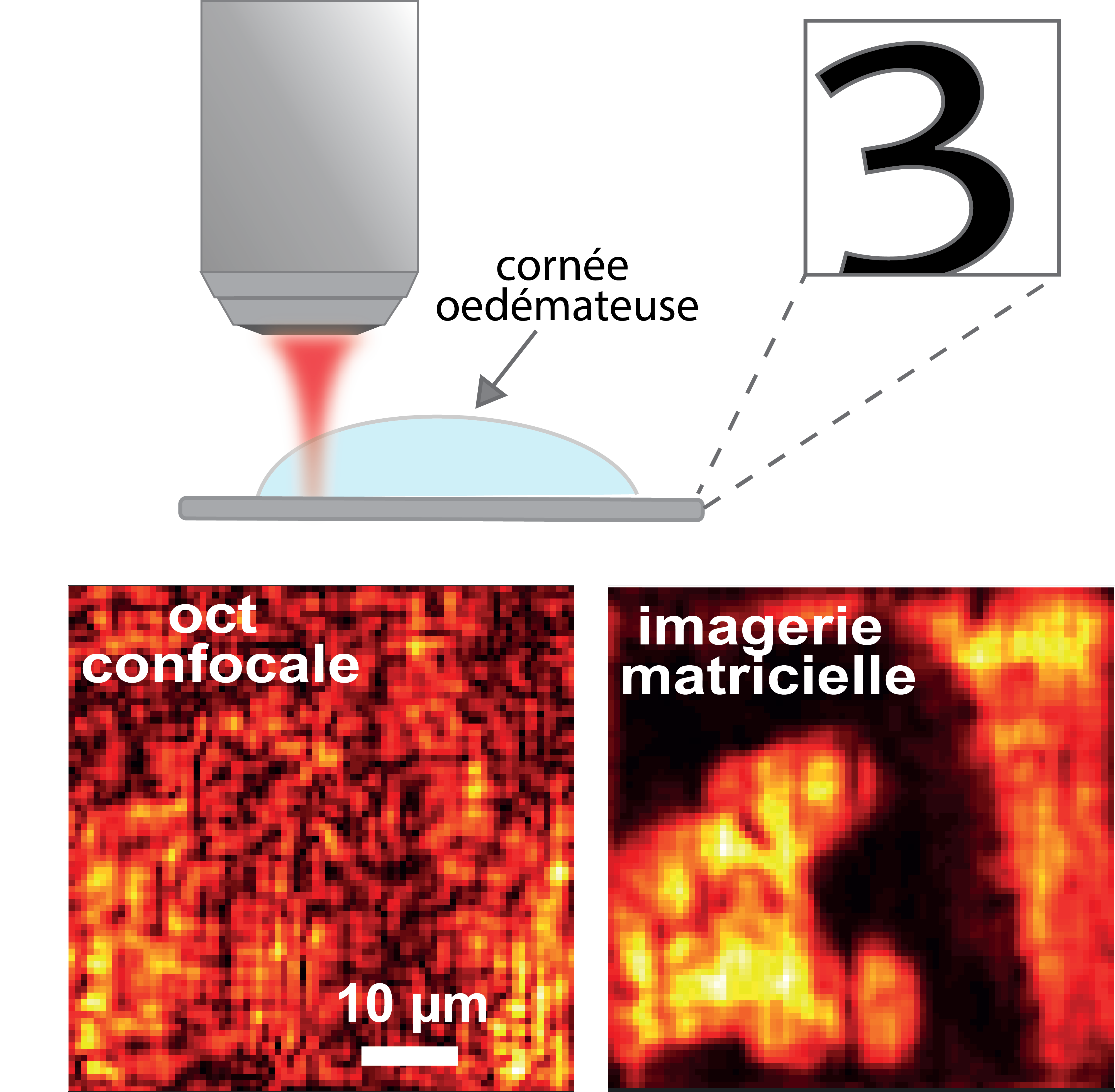 Augmenter la profondeur de pénétration des microscopes optiques