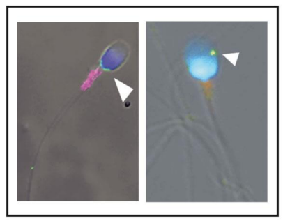 Le virus Zika retrouvé à l'intérieur des spermatozoïdes