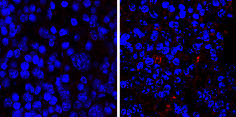 Décryptage du lien entre microbiote intestinal et allergie cutanée