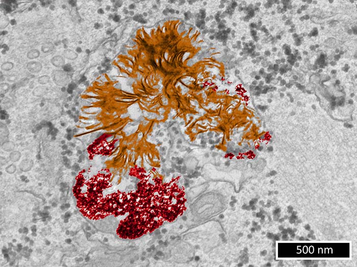 Que deviennent les nanoparticules d’or dans les cellules ?