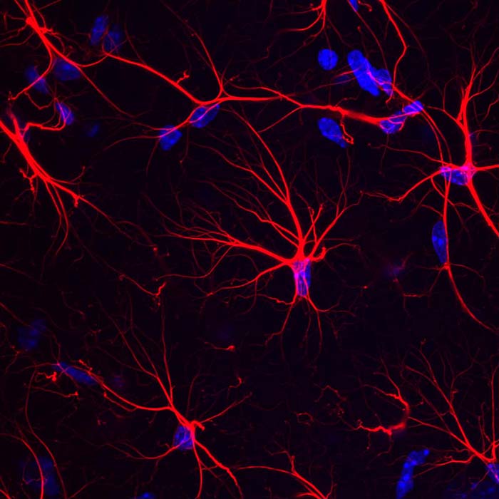 Alzheimer: un acide aminé pour aider à restaurer la mémoire ?