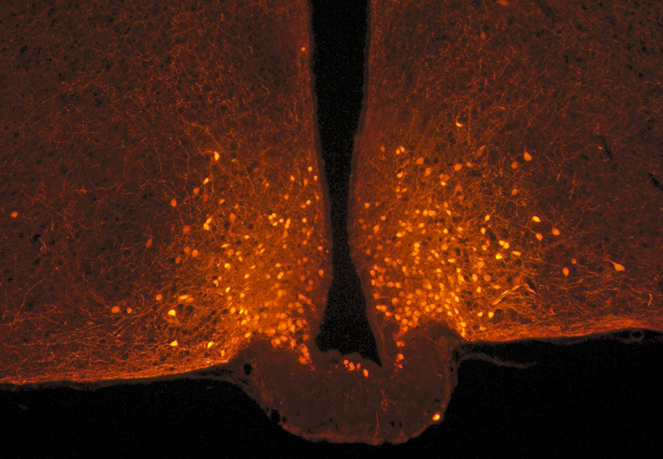 À l’origine de la satiété, des cellules du cerveau qui changent de forme après un repas