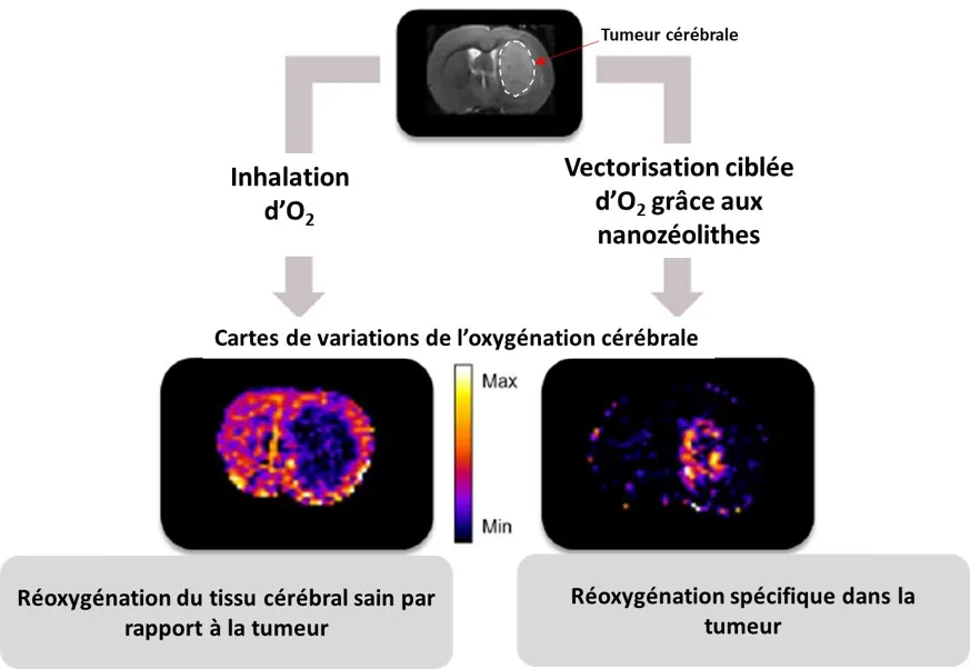 Des nanocristaux pour réoxygéner les tumeurs cérébrales