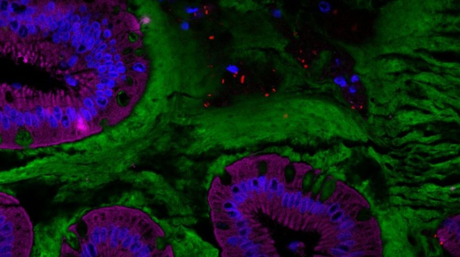 Un additif alimentaire altèrerait le microbiote et l’environnement intestinal humain