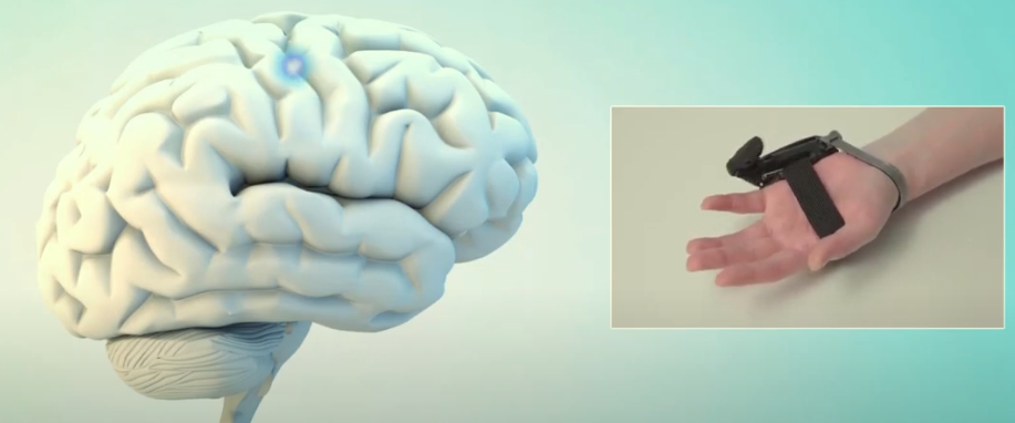 Comment notre cerveau accepte un membre robotique additionnel