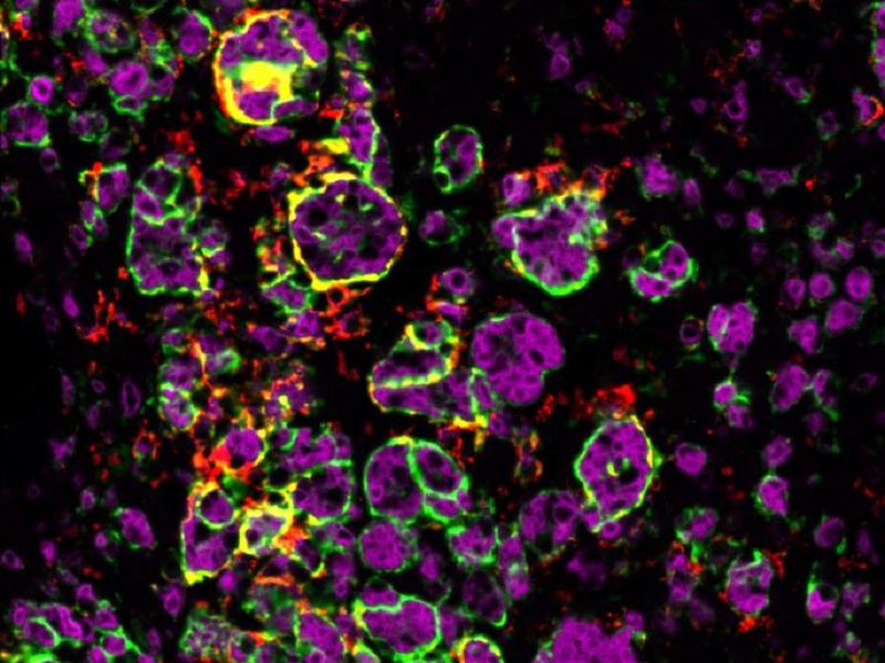 Une vertu anti-cancer de la testostérone