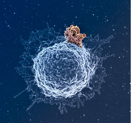 Une matrice extra-cellulaire protectrice à l'origine du pouvoir infectieux du VIH