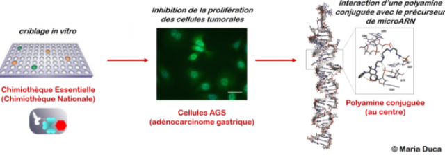 Cancer de l'estomac : la surproduction des microARN neutralisée