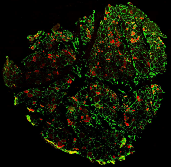 Myopathie: un gain de force musculaire chez la souris