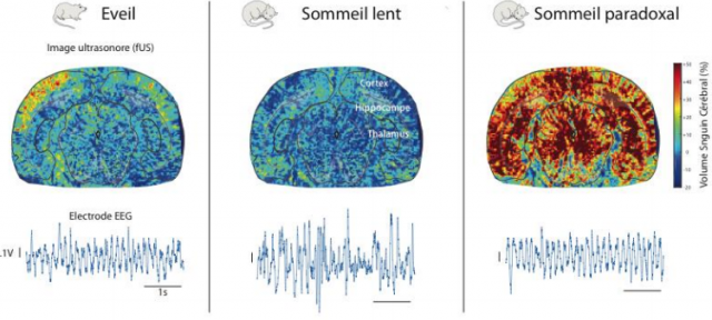 Filmer le cerveau pour mieux comprendre le sommeil
