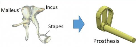 Des implants auditifs imprimables en 3D à base de collagène seront bientôt une réalité