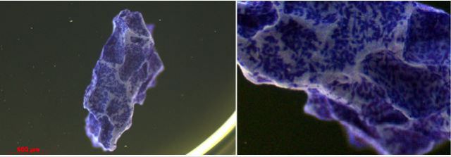 Des cellules souches et un biomatériau pour réparer les os