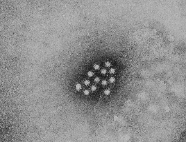 D-LIVER, un système de soins à domicile