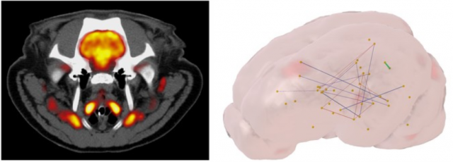 Edulcorants de synthèse : des effets métaboliques indésirables démontrés dans un modèle préclinique