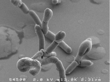 Une bactérie intestinale antidouleur