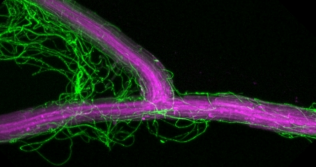 Symbiose en champignon et plante