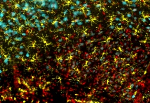 Pourquoi le cerveau a-t-il besoin des oméga 3 ?