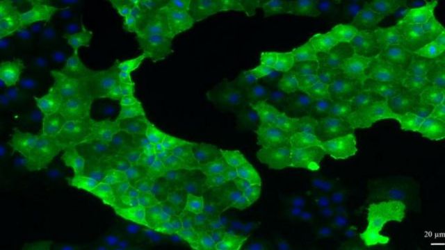 Maladies à prion : vers une réduction de l’expérimentation animale