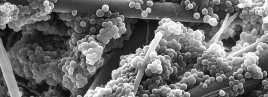 🦠 Découverte d’un mécanisme de survie du staphylocoque doré dans le sang
