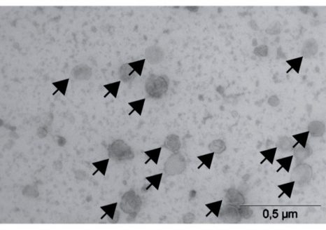 Immunothérapie: une nouvelle arme deux-en-un contre les tumeurs résistantes