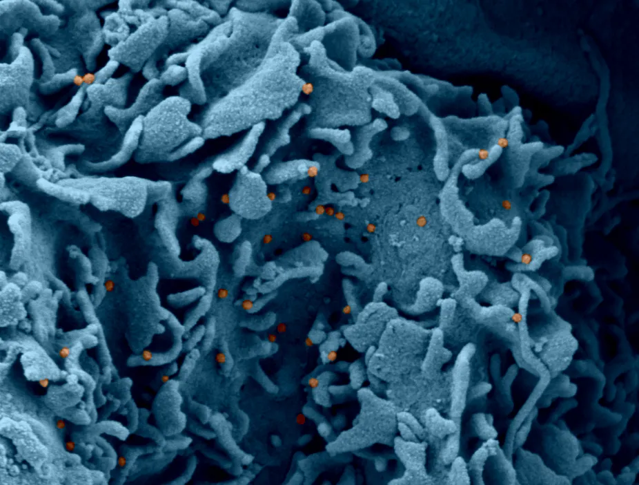 Covid-19: la combinaison infection-vaccination, meilleure protection d’une réinfection