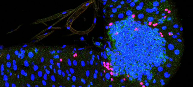 Cancer, vieillissement, cellules souches : les liens se resserrent
