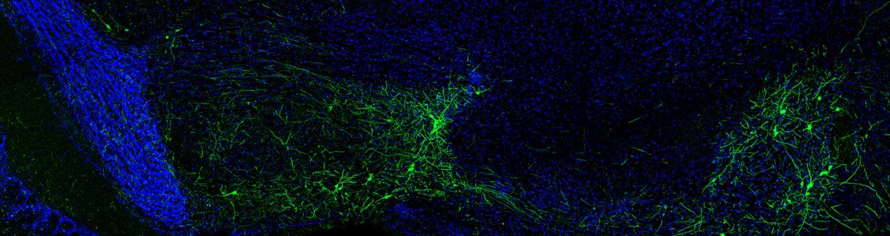 Identification d’une nouvelle voie nerveuse essentielle pour affiner la perception des odeurs