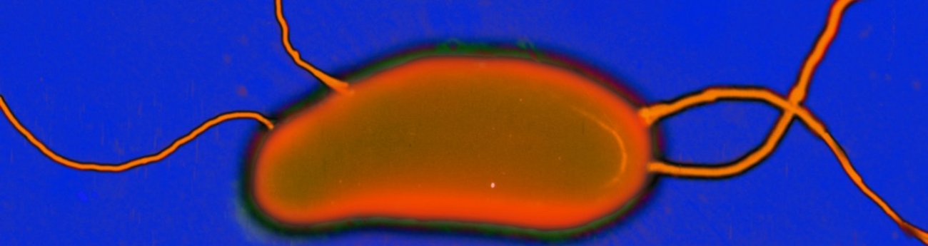 Épidémie de choléra au Yémen: identification de gènes favorisant le développement de la maladie
