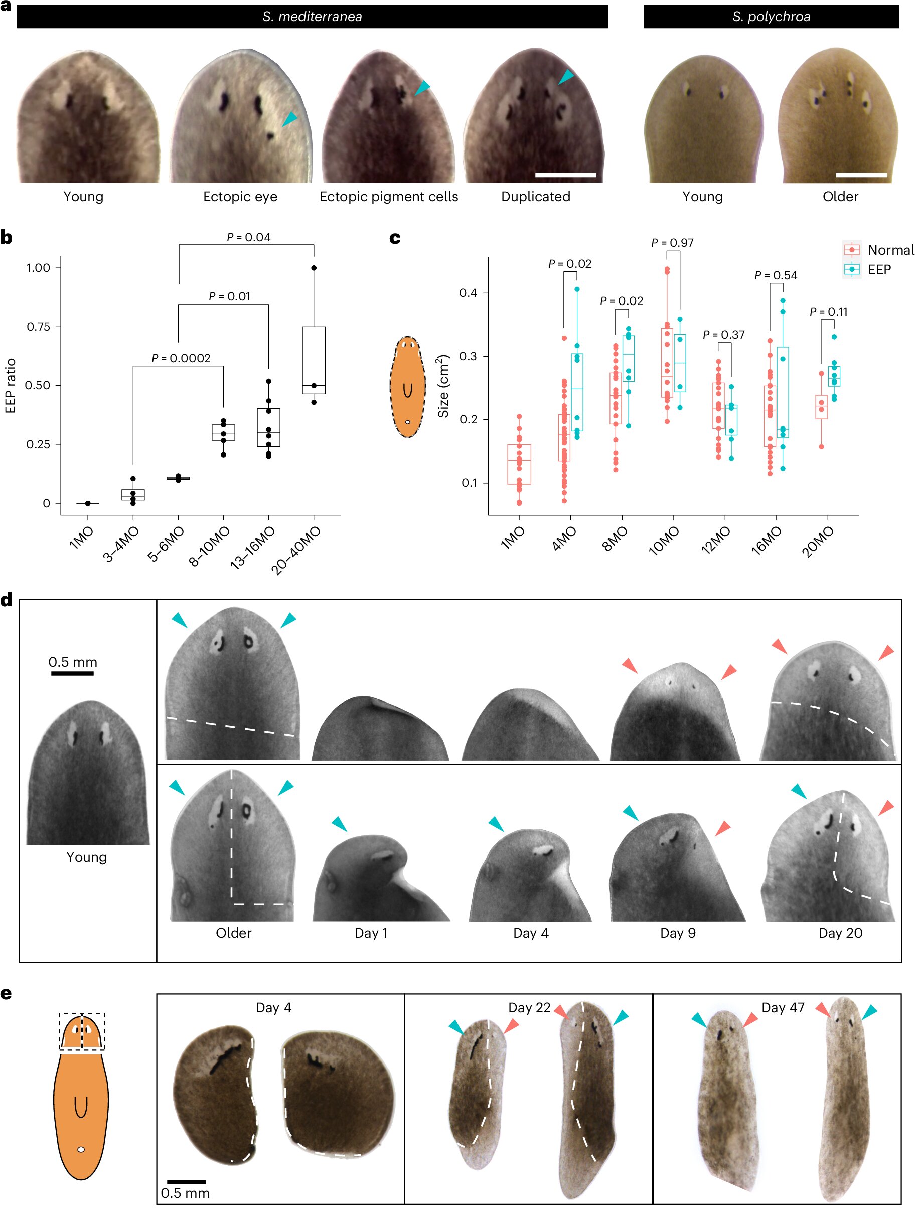 Planarians, these immortal beings that rejuvenate while we age 🔄