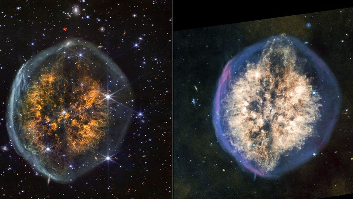 🔭 Tel un crâne translucide qui protège un cerveau cosmique