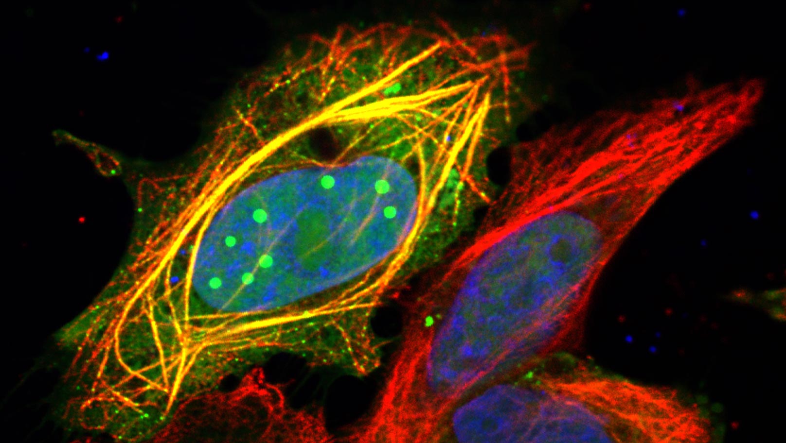 🔬 Virus de la rage : comment un virus si réduit peut-il dominer une cellule humaine ?