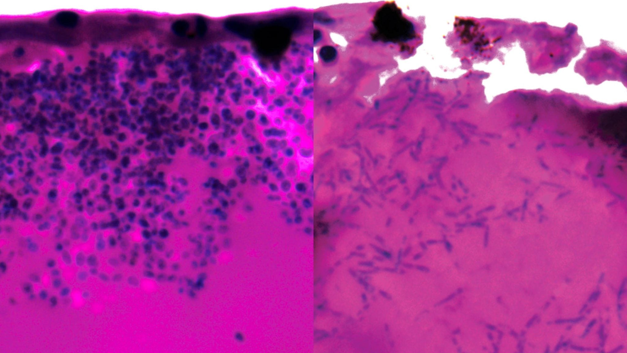 🔬 Uma fraqueza descoberta no fungo invencível dos hospitais