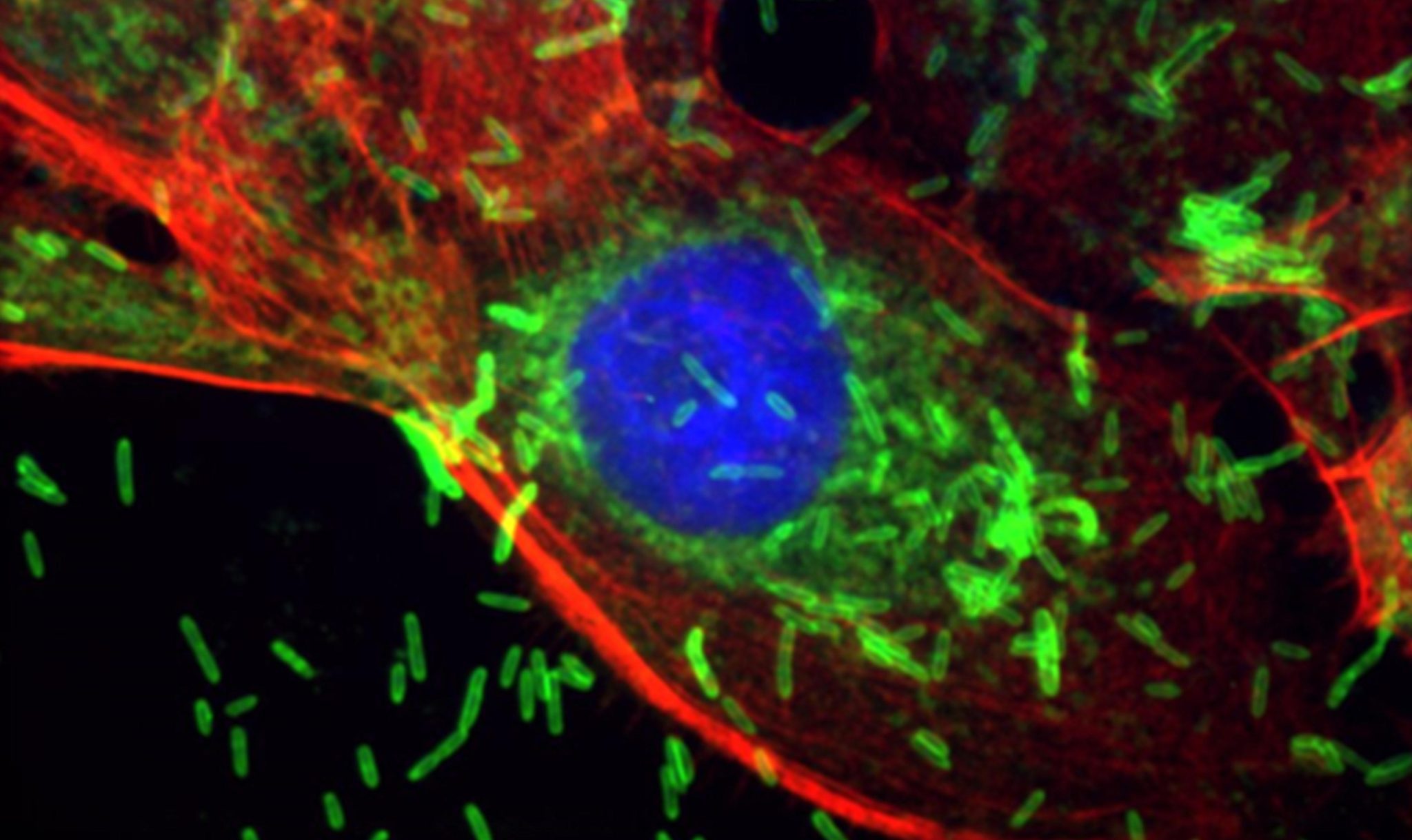🦷 Une bactérie présente dans la bouche liée au cancer du sein