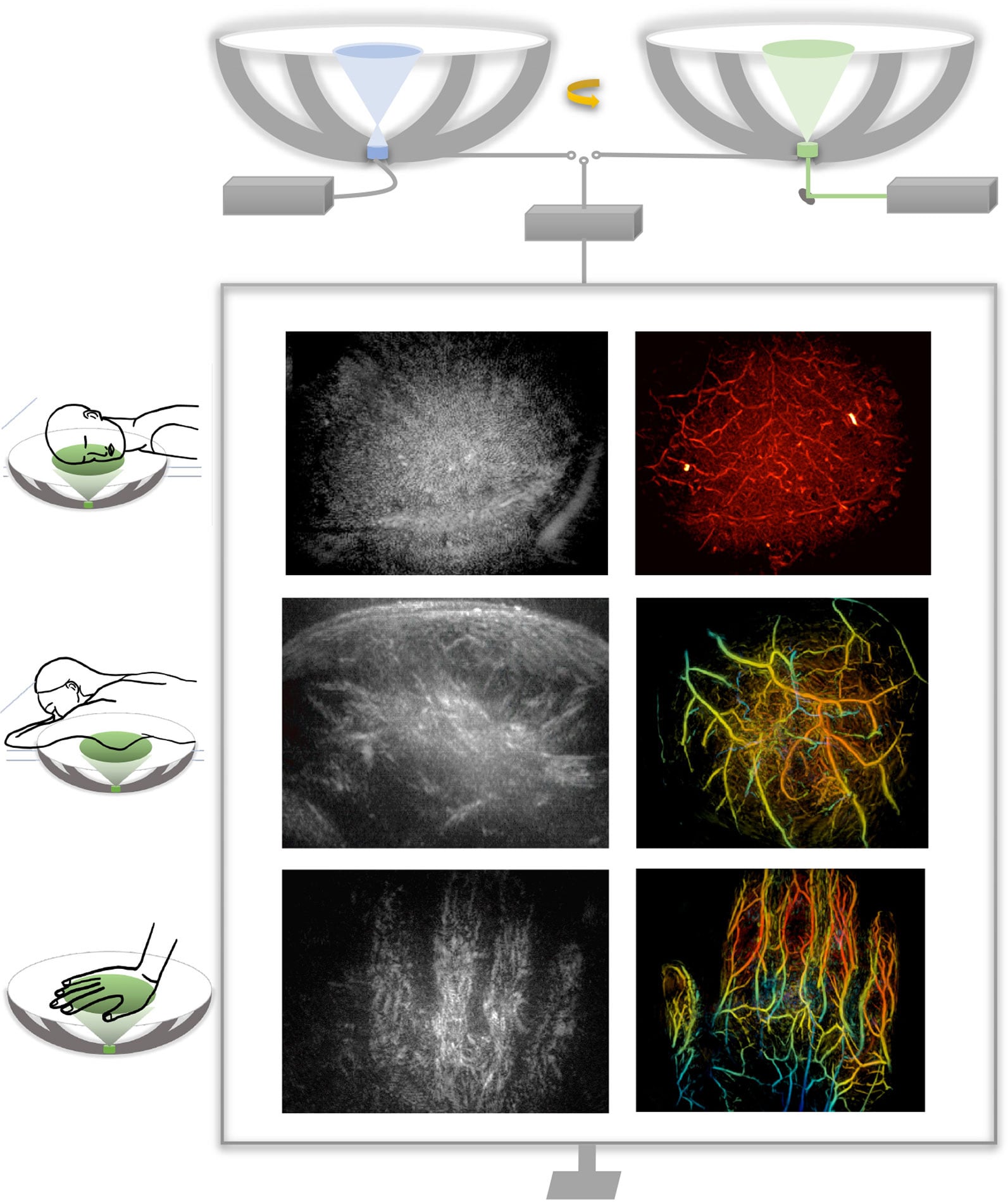 🩺 Une nouvelle technologie pour des images médicales avec 3D, couleurs et mouvements