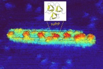 Découverte sur la propagation du prion