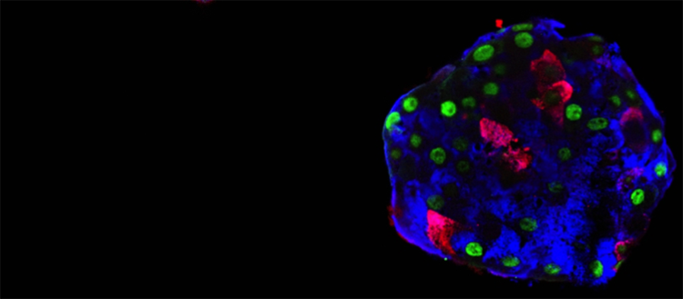 Les cellules humaines peuvent aussi changer de métier
