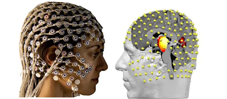 Une méthode douce pour percer les mystères du cerveau profond