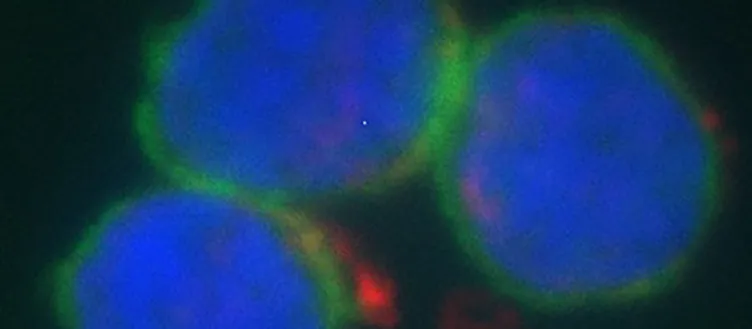 Des médicaments en or massif pour aider le système immunitaire