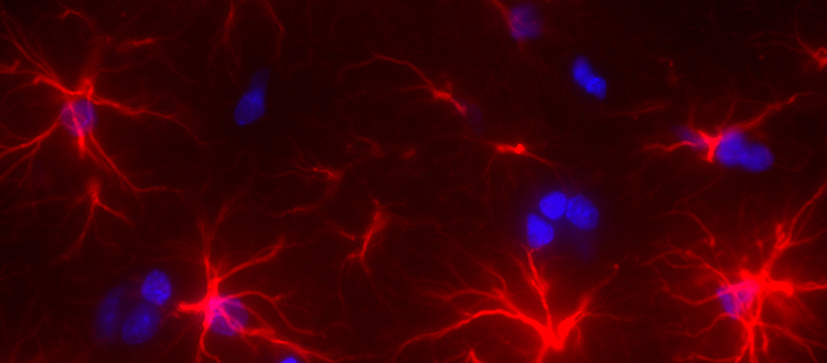 Quand le foie malade dérègle le cerveau