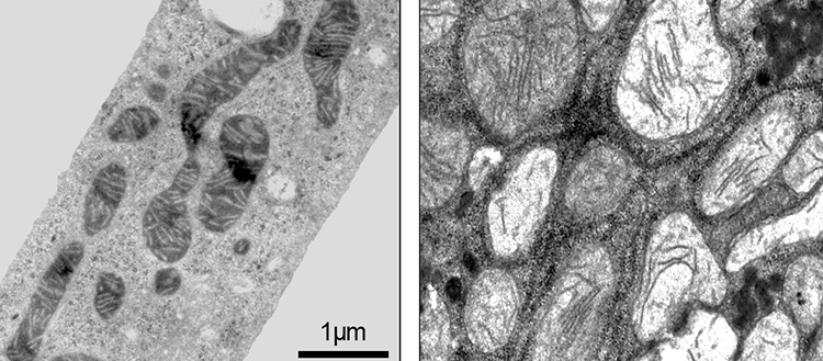 Le diabète de type 2 ne serait pas qu’une histoire d’insuline