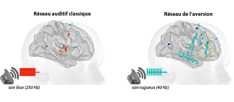Quand les sons d’alarme irritent le cerveau