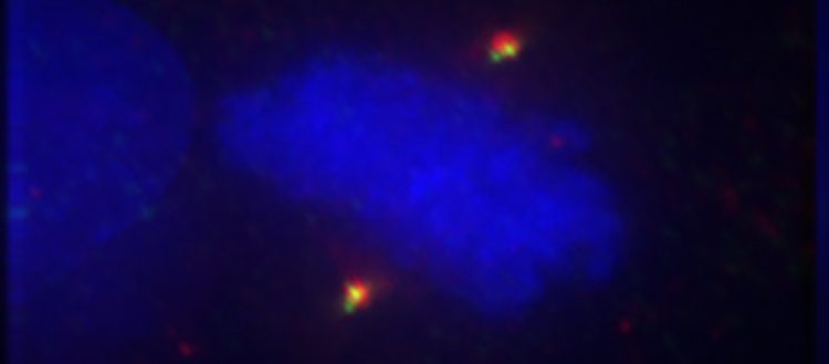 Une nouvelle arme chimique contre le cancer
