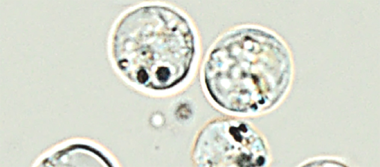 Les nanoparticules perturbent les algues
