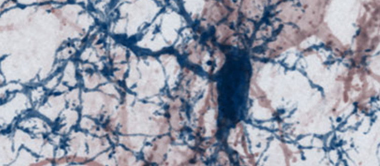 Réparer les synapses pour combattre la sclérose en plaques