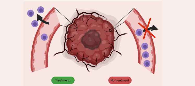 Combiner immunothérapie et médicaments contre le cancer