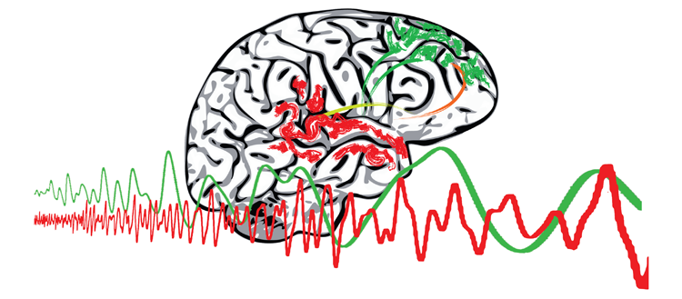 Un défaut de communication lors de troubles psychotiques