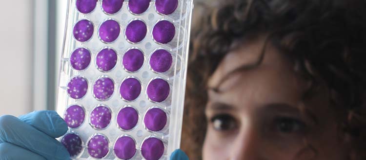 Comment Omicron échappe au système immunitaire