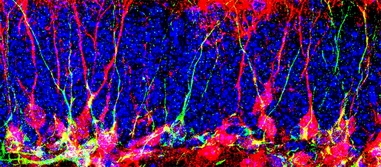 Comment générer de nouveaux neurones dans le cerveau