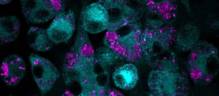 Une combinaison de médicaments contre l’antibiorésistance