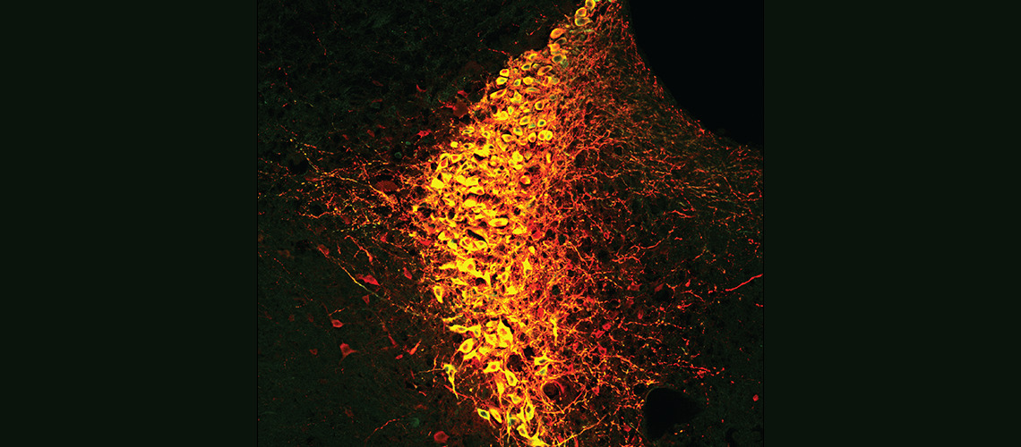 Our state of attention depends on so few neurons